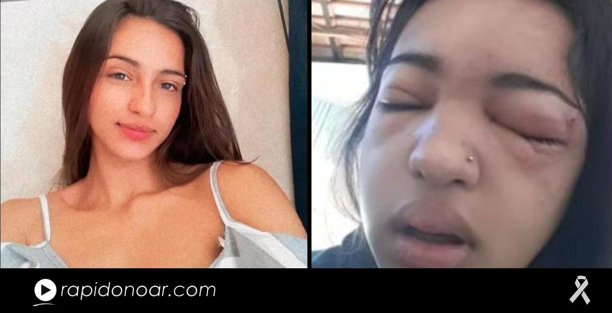 Jovem de 15 anos morre de infecção após colocar piercing em casa, em MG -  Jornal O Globo